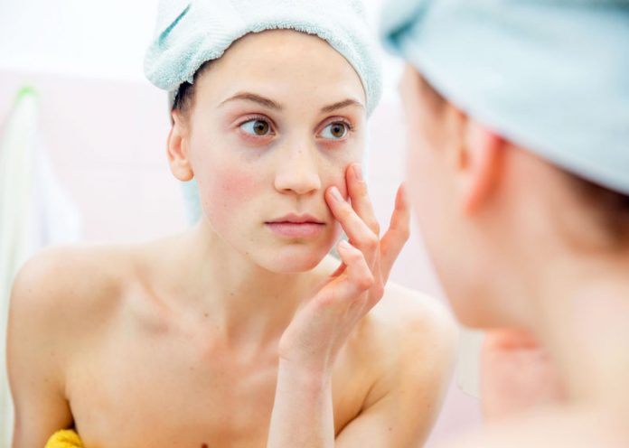 4 rimedi naturali per il problema dei pori dilatati del viso