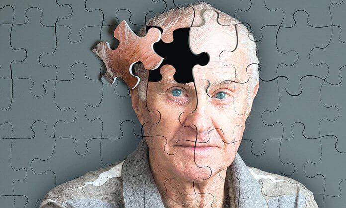 Alzheimer, come riconoscere i primi sintomi