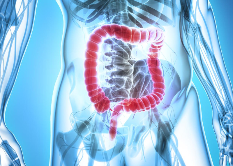 3 rimedi naturali efficaci per la pulizia del colon