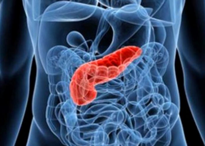 Un tumore in rapida crescita a causa di sigarette, obesità e cattiva alimentazione