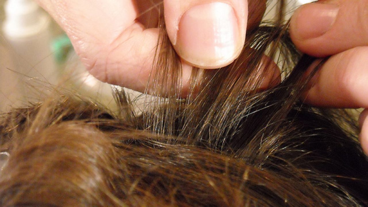 Pidocchi Attenzione Ai Vostri Bambini E Come Eliminarli Benessere Alimentazione Sana Prodotti Bio E Rimedi Naturali Soluzionibio It