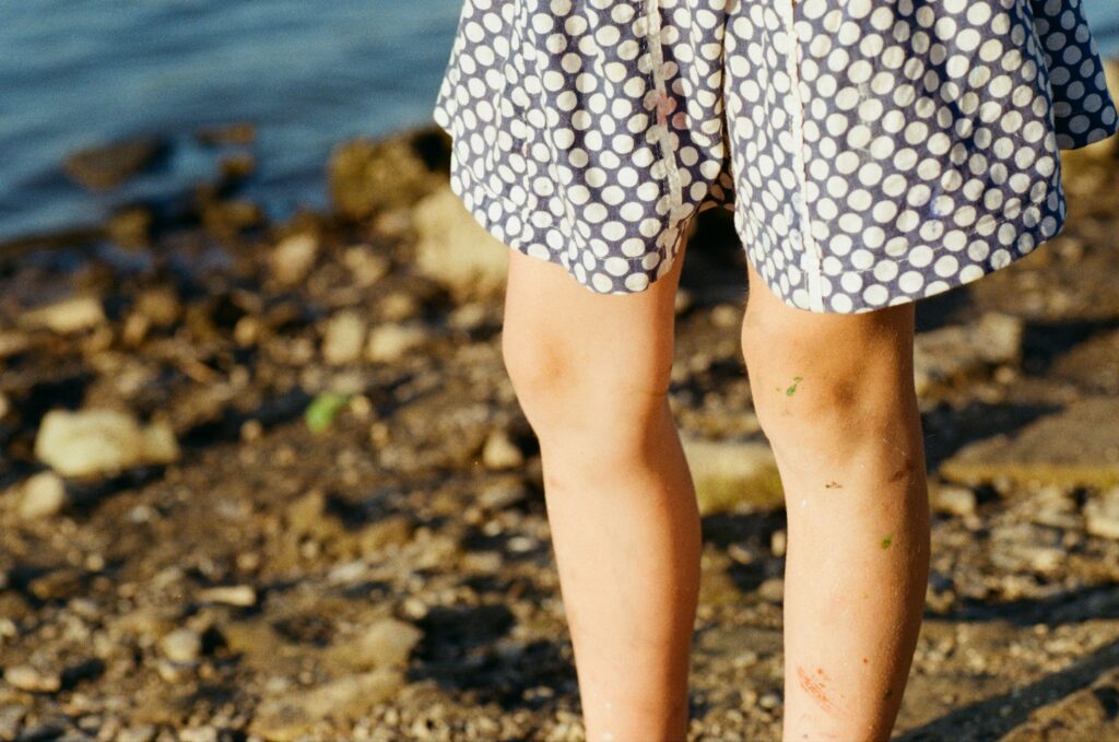 gambe pesanti in estate