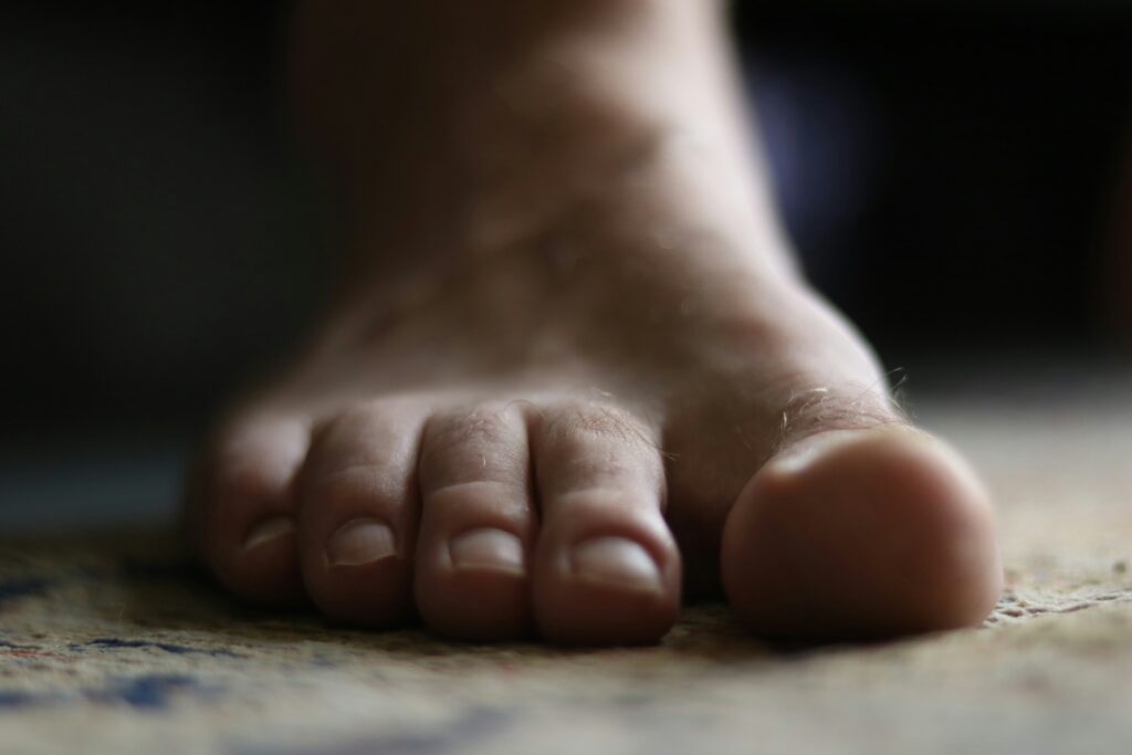 piedi gonfi