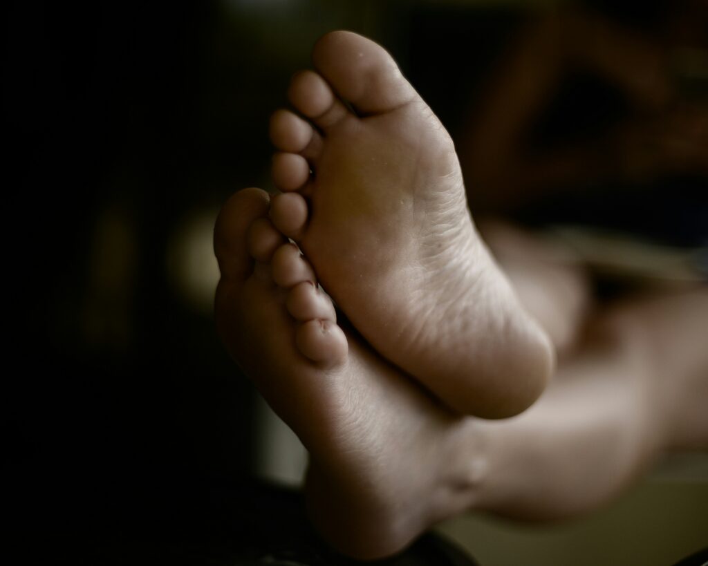 piedi gonfi